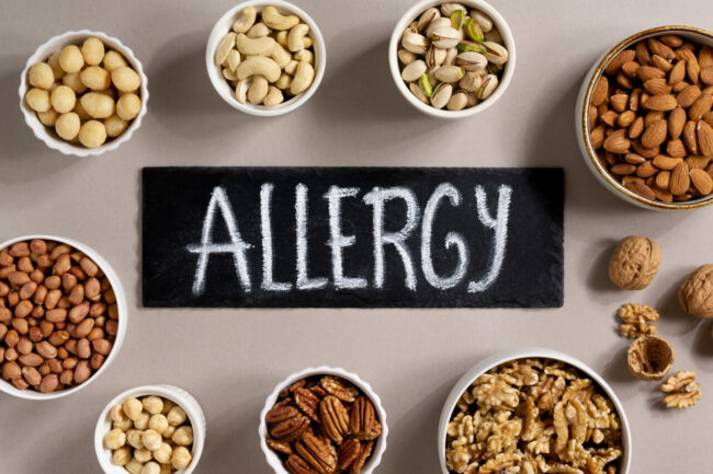 The 10 Most Common Food Allergies