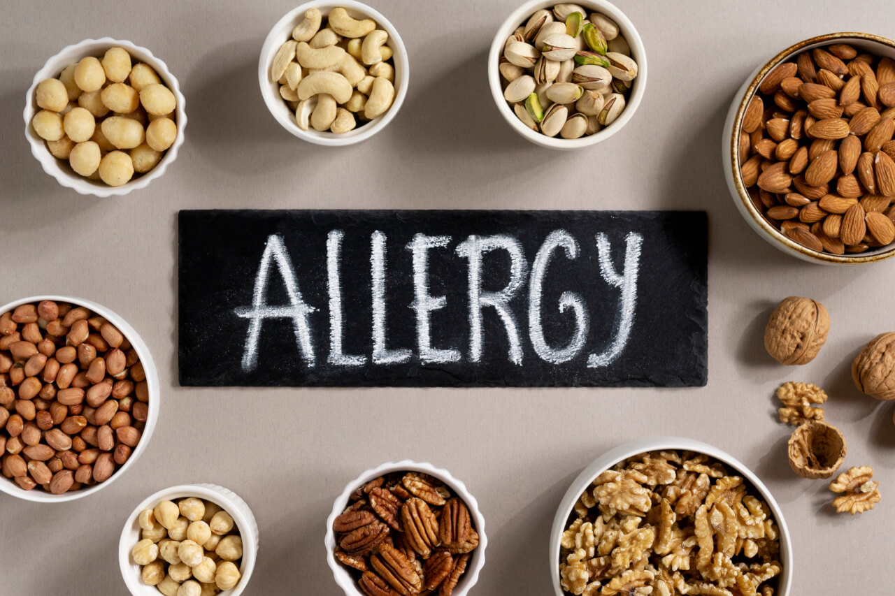 Alergias Alimentarias