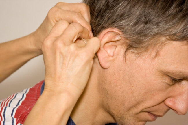Pimples in Ear Versus Ear Cysts: A Definitive Guide