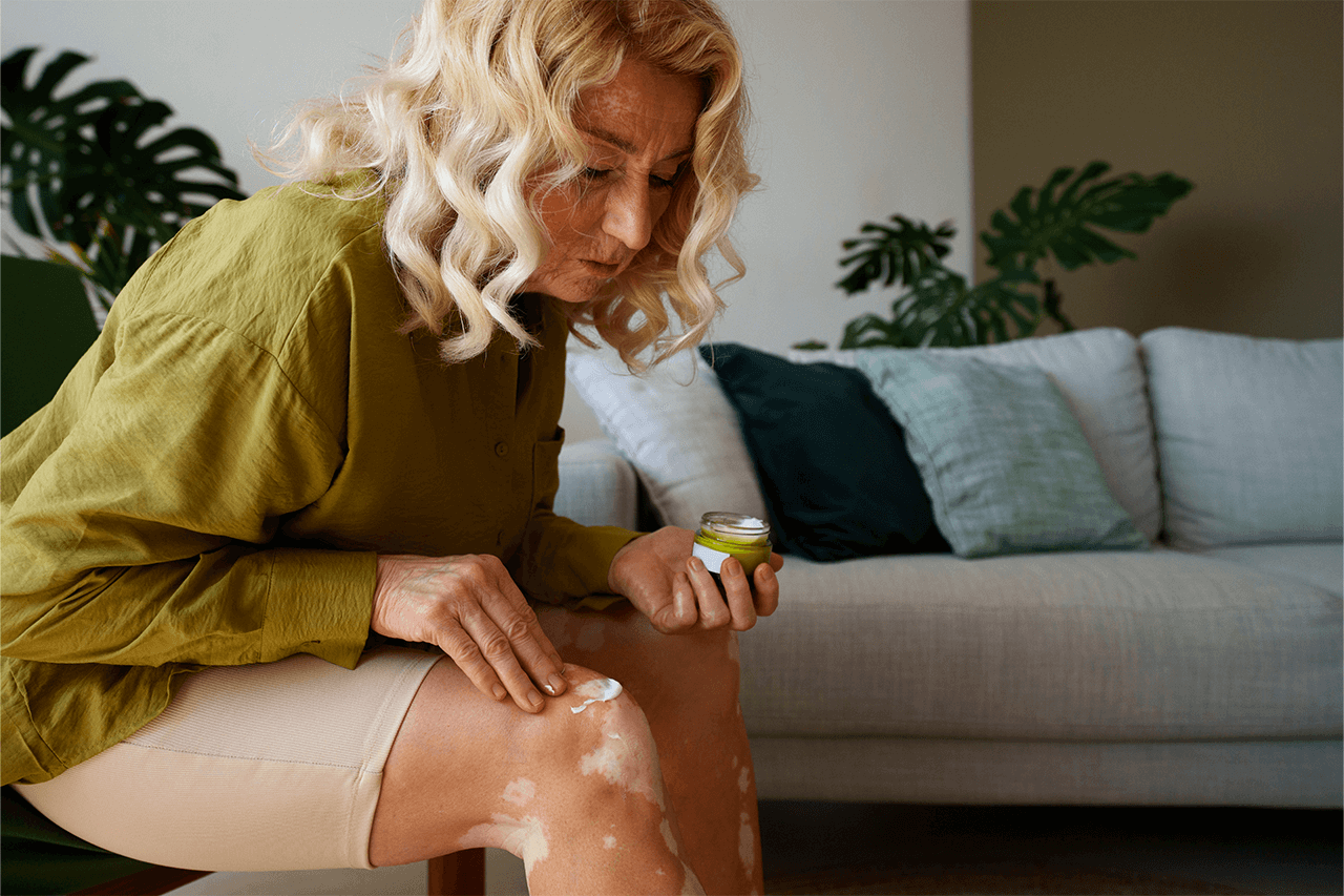 Discover Grandma’s 6 Secret Remedies to Soothe Your Aching Knees
