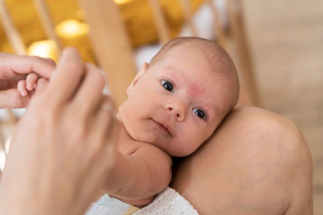 Cuidado Natural de la Piel del Bebé: Qué Usar y Evitar