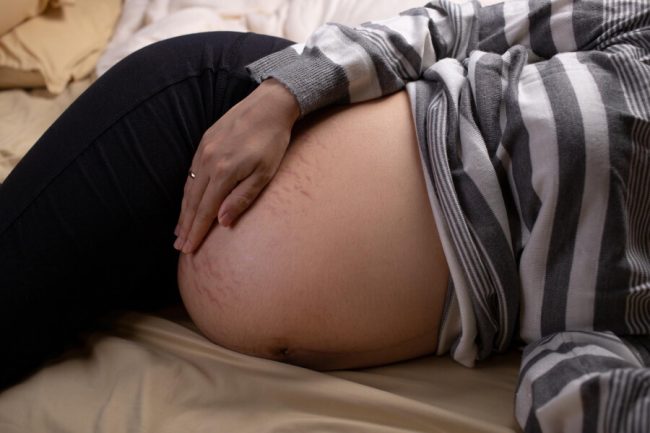 Dealing with Scabies During Pregnancy: Safe Options