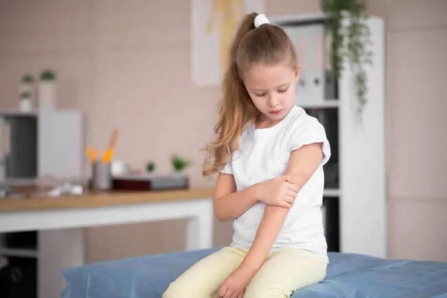 Home Remedies for Scabies in Children: What You Should Know