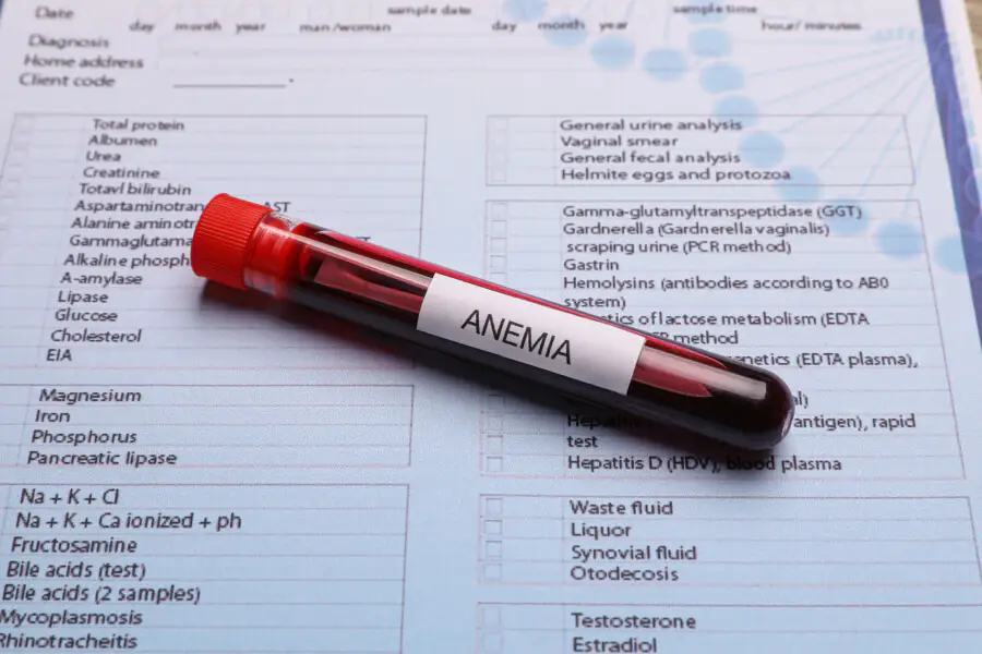 Understanding Anemia Across Different Ages